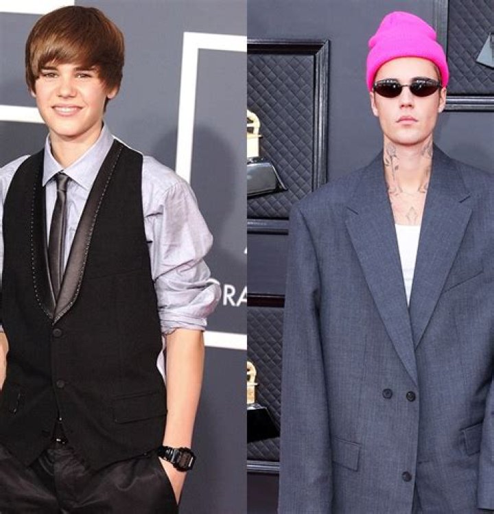 Justin Bieber’s Face & Smile Revealed After Ramsay Hunt Syndrome – Hollywood Life