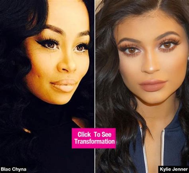 [PIC] Blac Chyna Had Plastic Surgery? Fans Slam Her After Transformation Pic – Hollywood Life